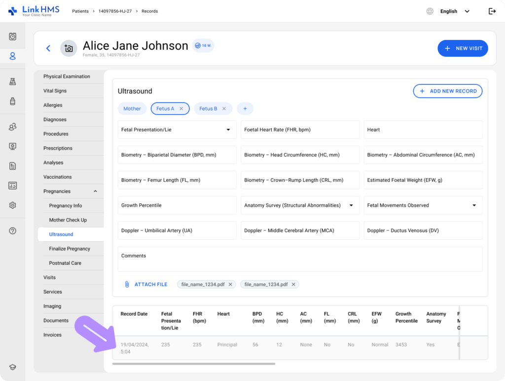 LinkHMS ultrasound 30